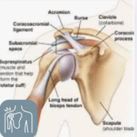 Causes of Shoulder Pain and Injuries